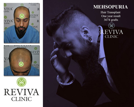 Slider image (9) Reviva Clinic